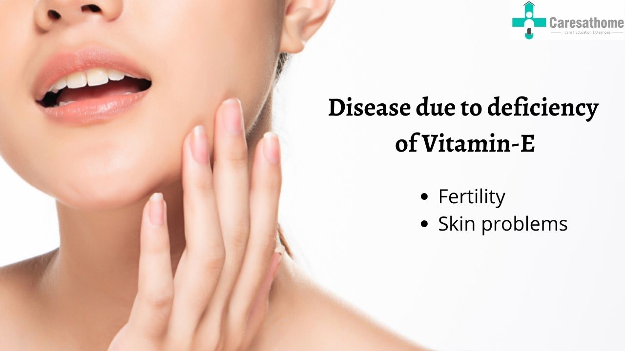 Vitamin E Deficiency Skin