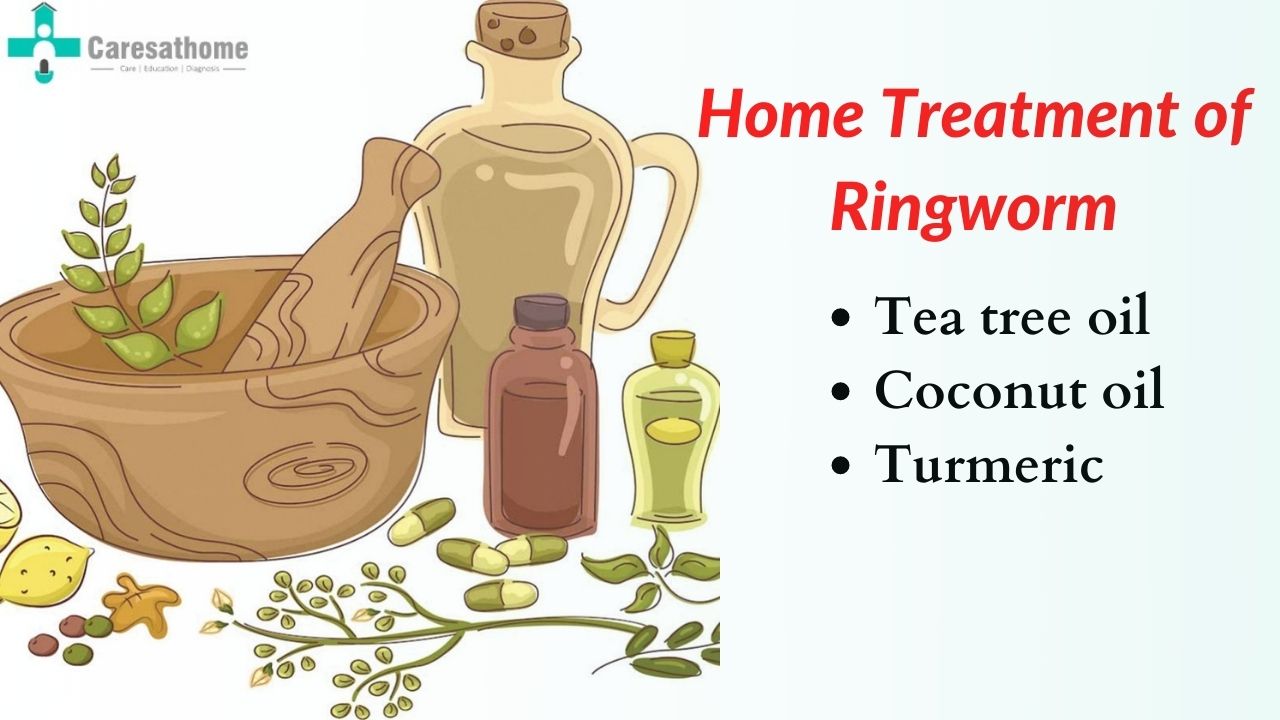 5 Fast Acting & Simple Home Remedies for Ringworm - YouTube